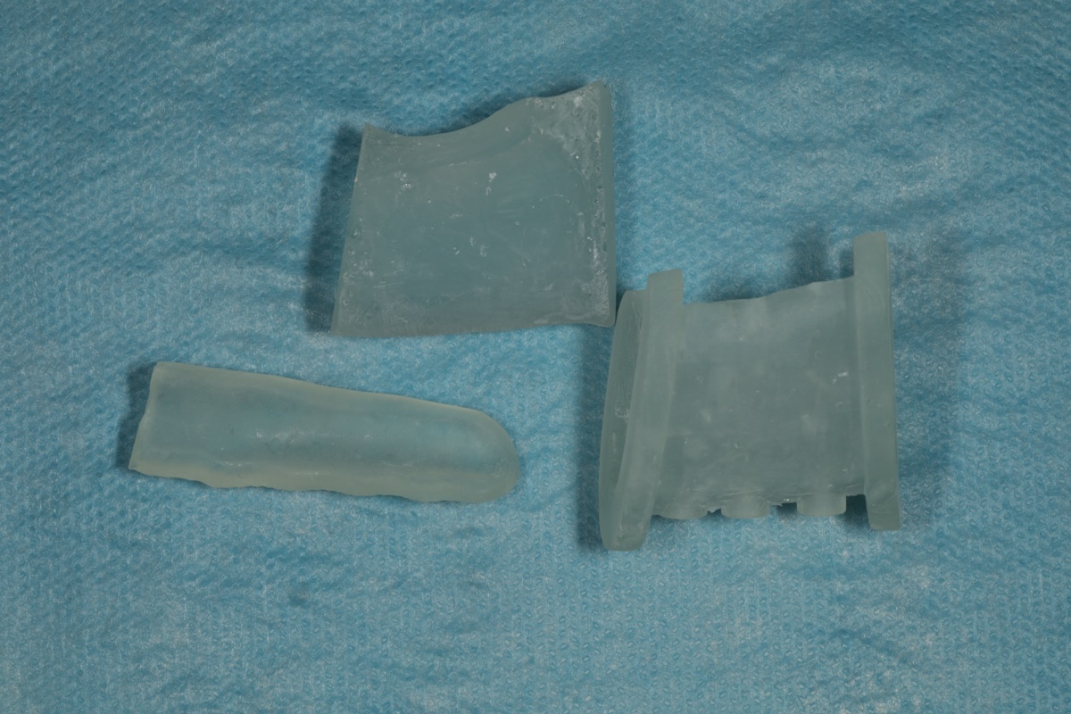 3D-printed cutting guide components ready for sterilization